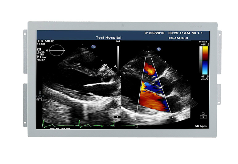 ����� | �ٷ���վ